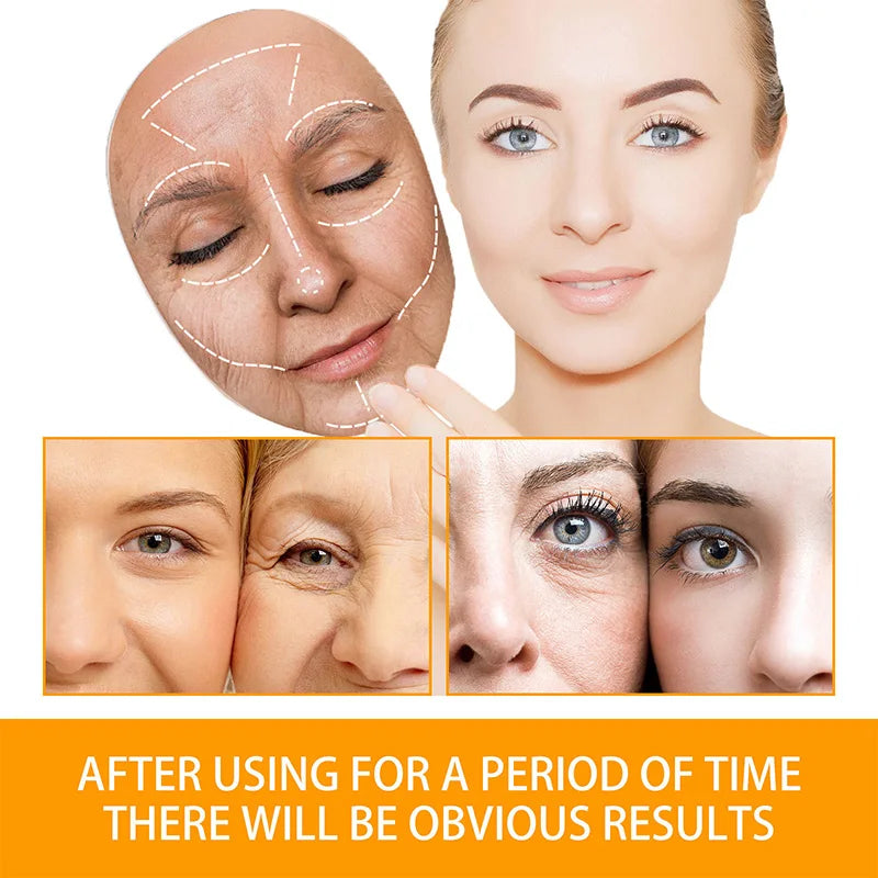 Anti Acne Turmeric Cream