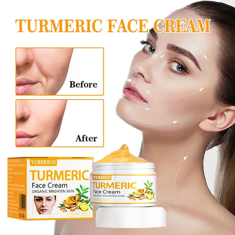 Anti Acne Turmeric Cream