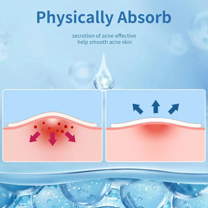 180/360PCS Invisible Acne Sticker