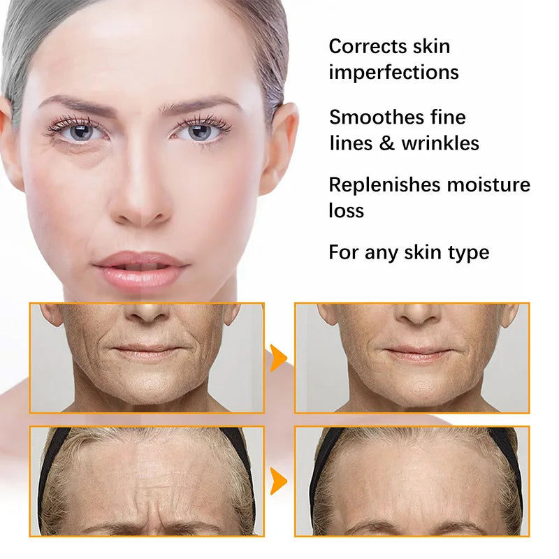 Anti Acne Turmeric Cream